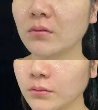 ネイル aliaハイフ&水光ジェットサロン所属・aliaハーブ水光店 エステティシャン募集のエステ・リラクイメージ