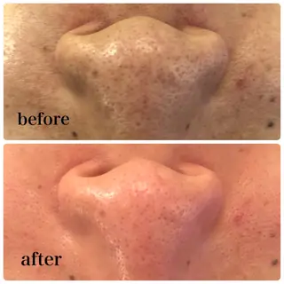 Salon de cheri サロンドシェリ人形町店所属・毛穴のお悩み・シミ 松本瞳のエステ・リラクイメージ