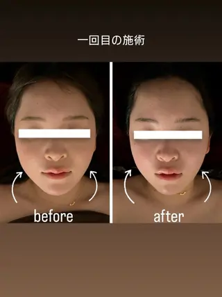 鍼灸サロン優癒所属・鍼灸リラクゼーション サロン優癒のエステ・リラクイメージ