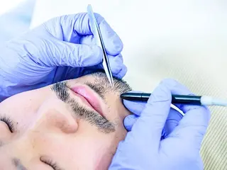 メンズ 【一本ずつ脱毛】 ReMove 柏のエステ・リラクイメージ