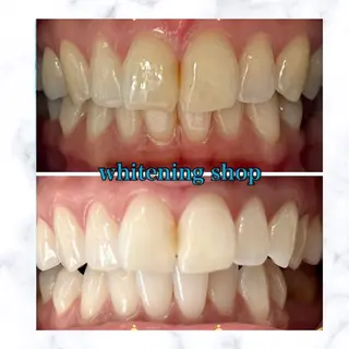 ホワイトニングショップ時津店所属・ホワイトニング ショップ長崎時津店のその他イメージ