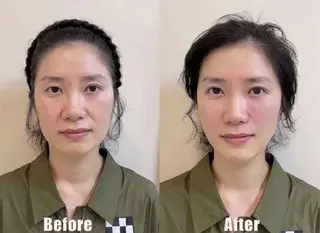 ネイル aliaハイフ&水光ジェットサロン所属・aliaハーブ水光店 エステティシャン募集のエステ・リラクイメージ