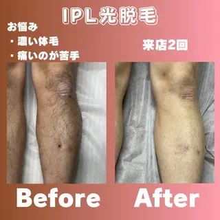 メンズ 効果重視脱毛サロンRICE所属・肌質改善/都度脱毛 Mahinaのエステ・リラクイメージ