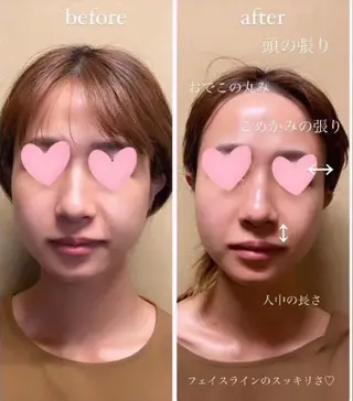 自律神経を整える フェイシャルエステのエステ・リラクイメージ