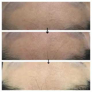 ビューティー ミロワールのエステ・リラクイメージ