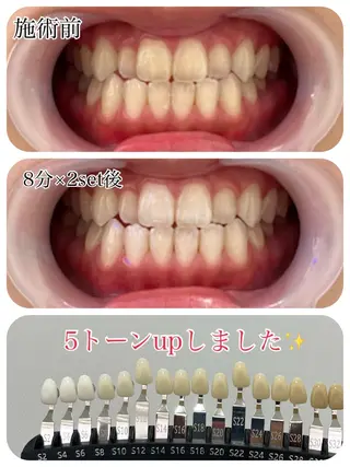 セルフホワイトニング 池袋　プラネットのその他イメージ