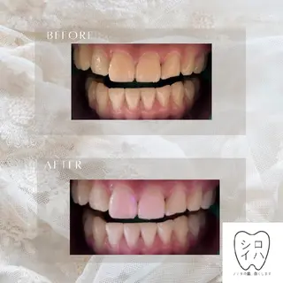 ホワイトニングサロン シロイハ所属・歯を白くしたい方🦷 シロイハのその他イメージ