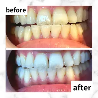 LBSホワイトニング 🌐渋谷店 河内のエステ・リラクイメージ