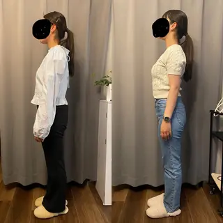 医療提携×美容整体 小顔ハイフピーリングのエステ・リラクイメージ