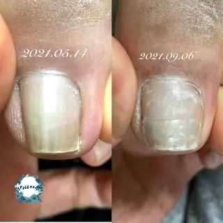 ネイル roconail ヒロコのネイルデザイン