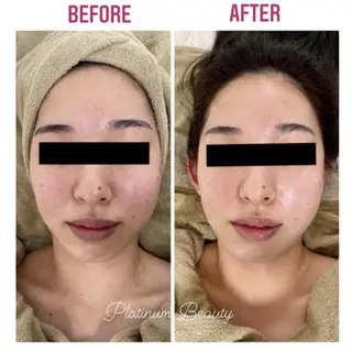 プラティーヌ ボーテ【もものり】のその他イメージ