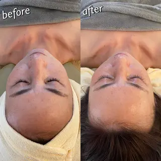 うなじ脱毛/美肌脱毛 LABELのエステ・リラクイメージ