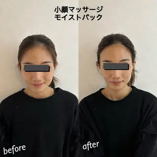 うなじ脱毛/美肌脱毛 LABELのエステ・リラクイメージ