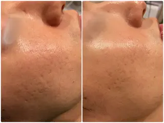 美肌・小顔専門🪄 看護師施術/松﨑のエステ・リラクイメージ