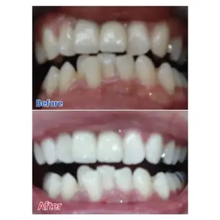 M渋谷店所属・Ｍ渋谷 ホワイトニングのその他イメージ