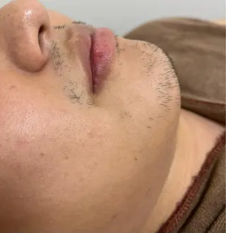 メンズ 脱毛SALON RaYNiCKのエステ・リラクイメージ