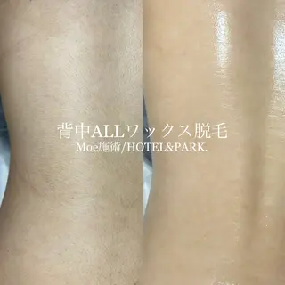 HOTEL&PARK .Moeワックス脱毛のエステ・リラクイメージ
