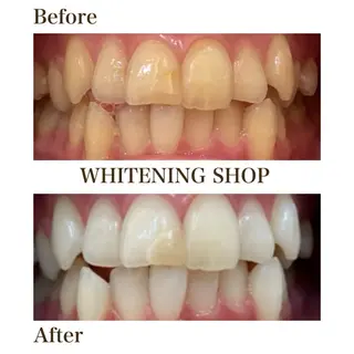 メンズ ホワイトニングショップ静岡葵区店所属・ホワイトニング ショップ葵区静岡駅店のその他イメージ