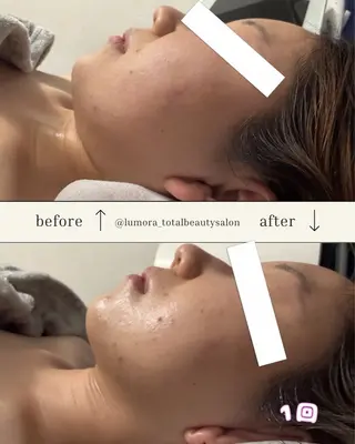 TOTAL BEAUTYSALON LUMORA所属・LUMORA🌟 トータルビューティーのエステ・リラクイメージ