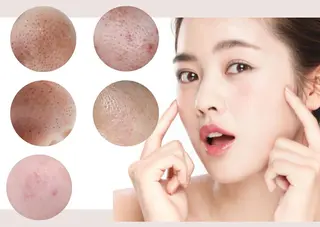 CLEAD赤坂見附店 坂田のエステ・リラクイメージ