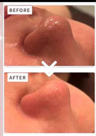 🦋肌改善 laule'a🦋のエステ・リラクイメージ