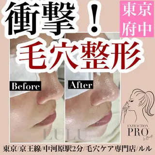 LULU所属・LULU ルルのエステ・リラクイメージ