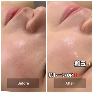 one day所属・肌質改善ハーブサロン ALA原宿のエステ・リラクイメージ