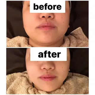 【大名】 NicoLのエステ・リラクイメージ