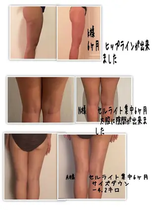 LOMILOMI Naoのエステ・リラクイメージ