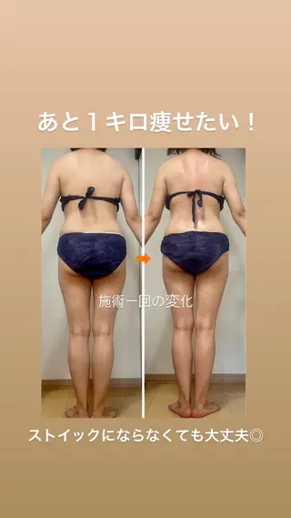 痩身&ボディ 結果出し🌟丹野のエステ・リラクイメージ