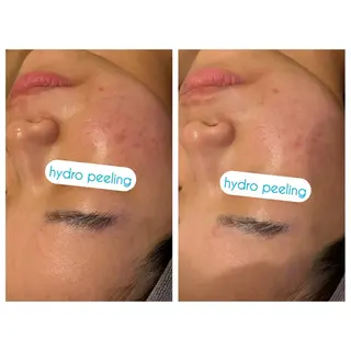 ☆痩身/小顔☆ 結果出します☆のエステ・リラクイメージ