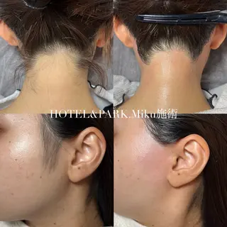 HOTEL&PARK Mikuワックス脱毛のエステ・リラクイメージ