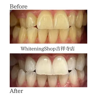 ホワイトニングショッ 吉祥寺2号店のその他イメージ