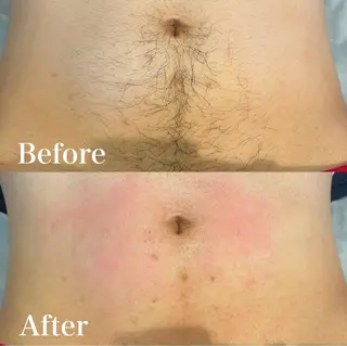 wax脱毛専門店 ハイラントのエステ・リラクイメージ