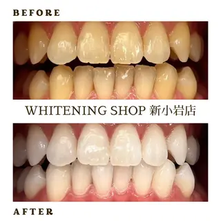 メンズ ホワイトニング ショップ新小岩店のその他イメージ