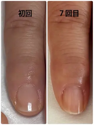 ネイル Alo.nail アロ•ネイルのネイルデザイン