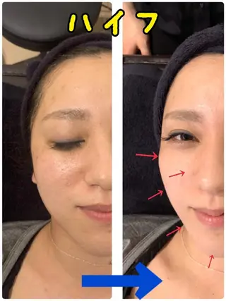 SESUNNY セサニー SEIRAのマツエク・マツパデザイン