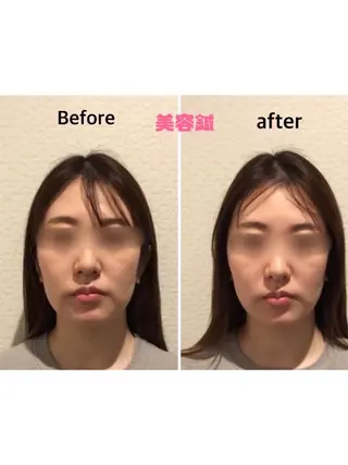 チキバン美容鍼灸整体 サロン心斎橋店のエステ・リラクイメージ