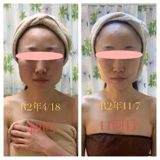 エステティック Nanagiのエステ・リラクイメージ