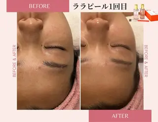 医療提携サロン&パーソナルカラー/骨格/顔タイプ診断 La chic所属・パーソナルカラー &エステ SHIHOのその他イメージ