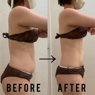 BeauL銀座 村浜友菜🤍のエステ・リラクイメージ