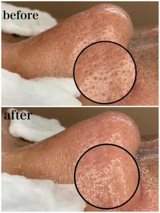 韓国肌管理 【毛穴専科】のエステ・リラクイメージ