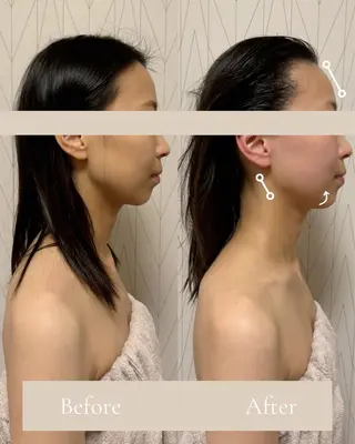 Lani Moon所属・⟡ 京都 小顔  ⊹ Lani Moonのエステ・リラクイメージ