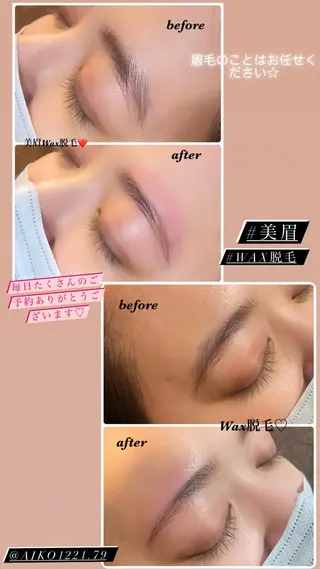 アイブロウ ハーブピーリング/韓国肌管理/フェイシャル/毛穴洗浄/眉毛/顔脱毛【糸脱毛専門】rev所属・ハーブピーリング🌹 毛穴洗浄❤️眉waxのエステ・リラクイメージ