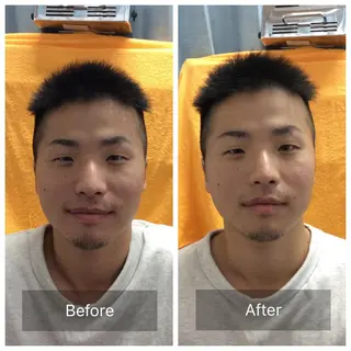 メンズ 美容鍼・整体 根本改善/小林幸司のエステ・リラクイメージ