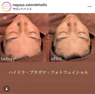 SALON DE HALLISサロン ド ハリス所属・八事 / サロンドハリスのエステ・リラクイメージ