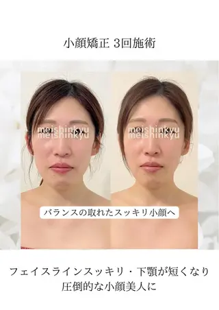 meishinkyu所属・小顔矯正  小林 香織のエステ・リラクイメージ