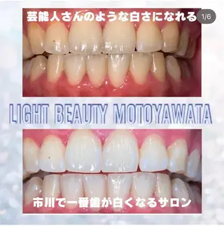 五十嵐 蓮のその他イメージ