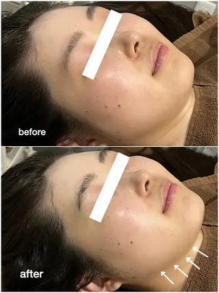 ENCHANT Kaede/肌質改善のその他イメージ