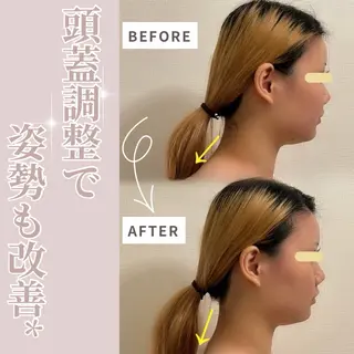 小顔セラピーLIL所属・小顔セラピー LILのエステ・リラクイメージ